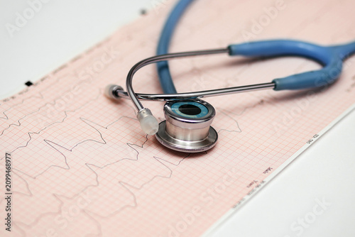 Quadro su tela Medical stethoscope placed on an ECG printout in a clinical setting