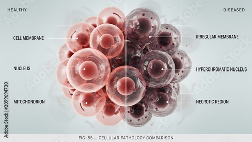 Scientific illustration comparing healthy cells with diseased cells in microscopic medical study transparent background