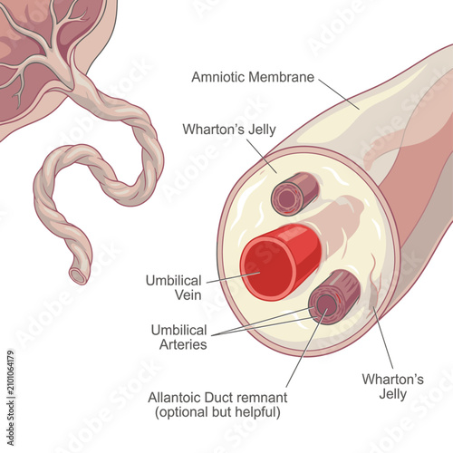 Detailed illustration of the umbilical cord structure, showing amniotic membrane, Wharton's jelly, umbilical vein, umbilical arteries, and allantoid duct remnant