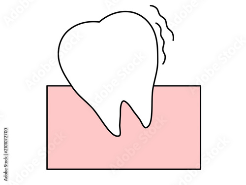 Illustration of a loose tooth