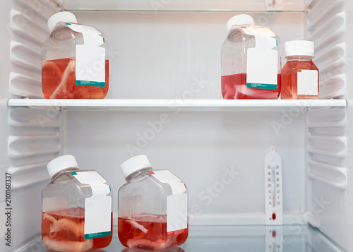 Donor arteries in saline jars in the refrigerator.