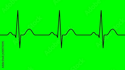 Abstract graphic representation of an electrocardiogram (ECG) showing a regular heartbeat pattern, set against a vivid green backdrop, embodying health, life, and medical science