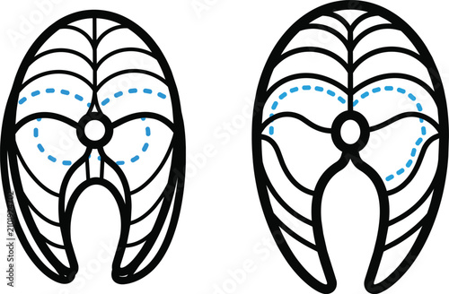 Black and white of lungs with highlighted airways and nodes lung respiratory system