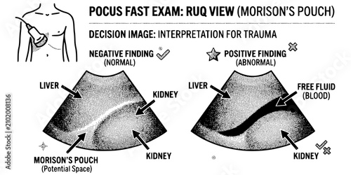 POCUS Emergency Stipple Black White-Probe FAST Exam View Decision Image-Ultrasound Vector-POCUS Icon Stipple-Emergency Medicine Design Set