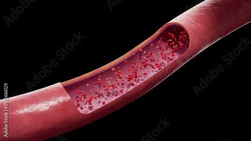 3D medical animation of red blood cells and cholesterol lipid particles flowing through a human artery