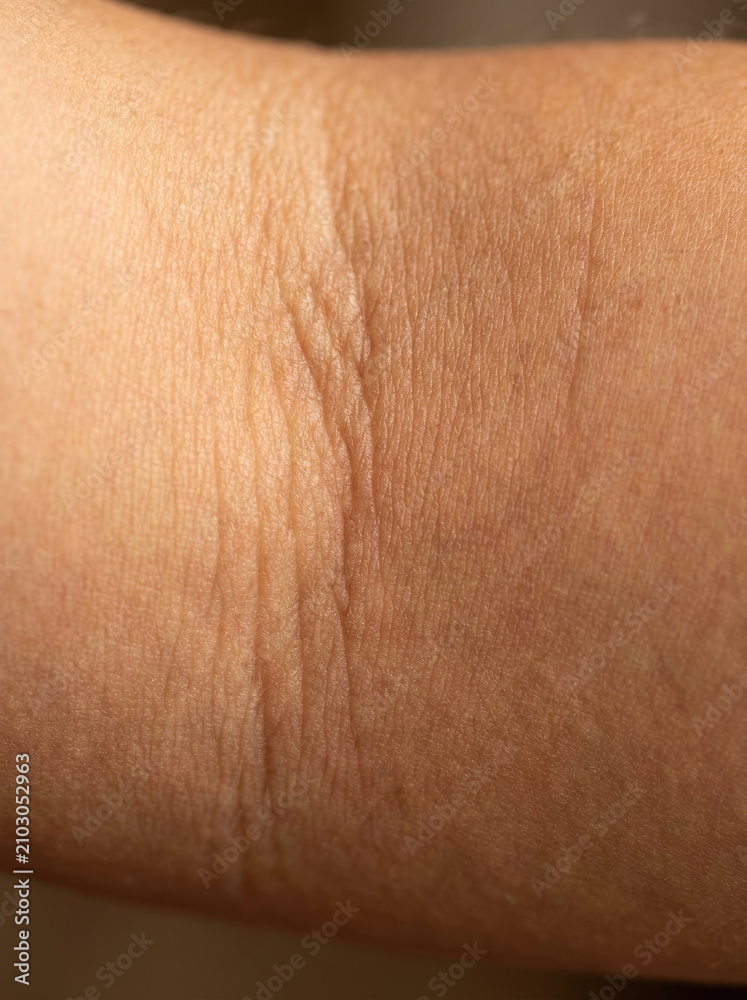 Fototapeta premium Skin fold macro image showing detailed texture and creases