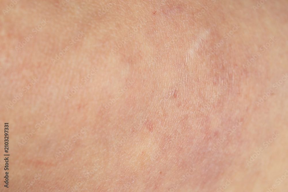 Fototapeta premium Texture of normal skin as background, closeup