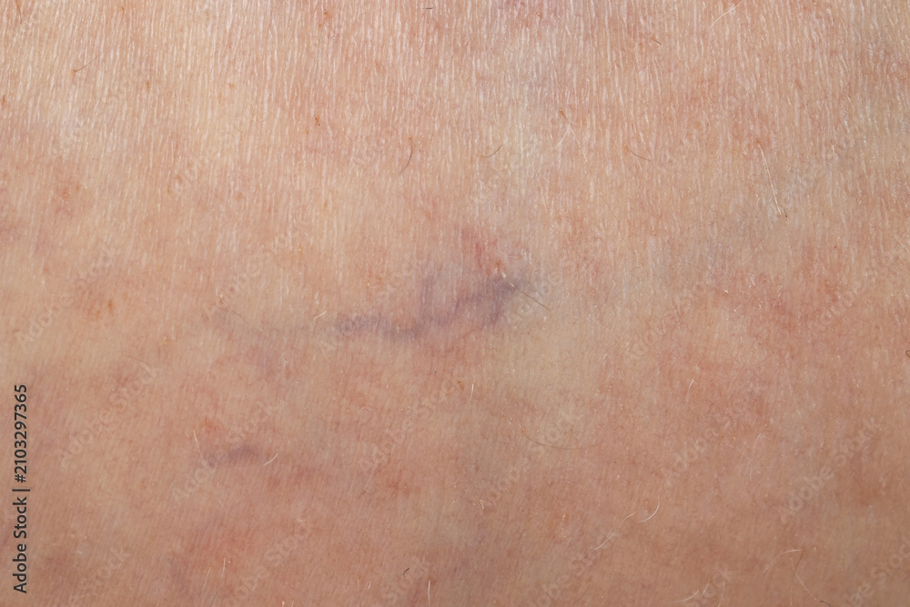 Fototapeta premium Texture of normal skin as background, closeup