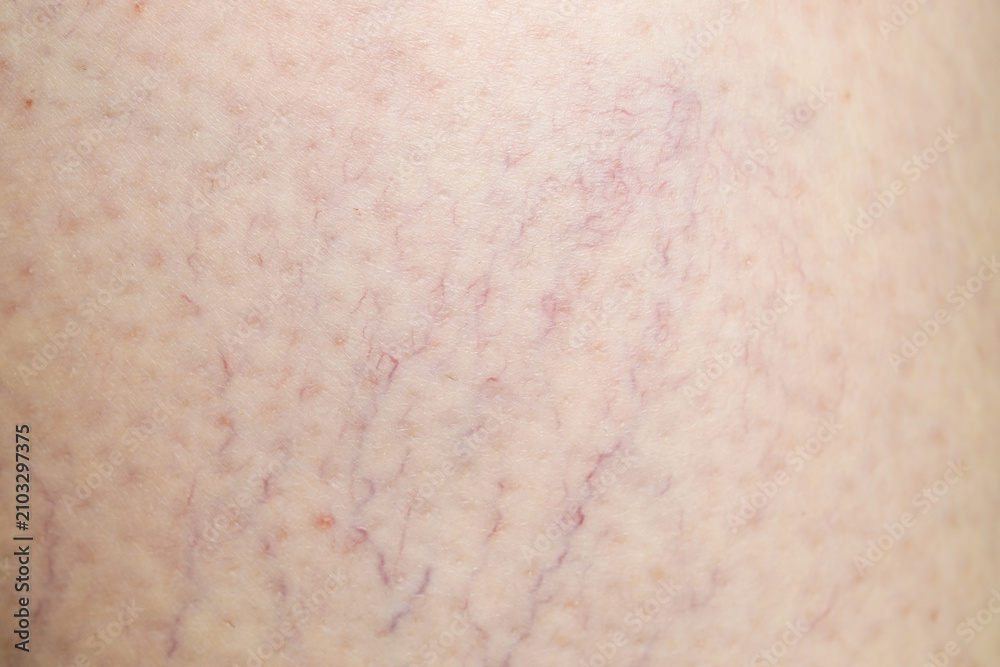 Fototapeta premium Texture of normal skin as background, closeup