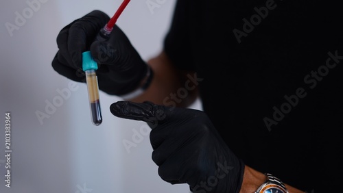 Gloved hand holding a blood test tube before an aesthetic procedure