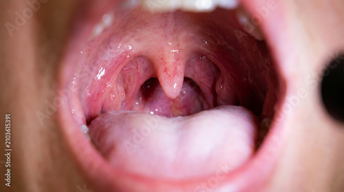 Close-up of human uvula and soft palate inside mouth