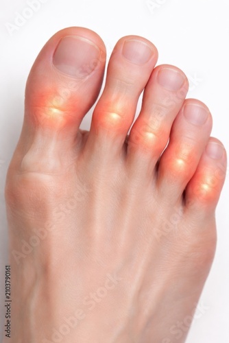 Close-up view of a foot with glowing toes on a white background, emphasizing skin texture and nail details for health and medical contexts