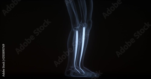 Tibialis anterior muscle in human body. X Ray. Loop