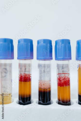 Centrifuged blood samples in collection tubes for hematology testing, clinical laboratory diagnostics, serum separation and medical laboratory analysis