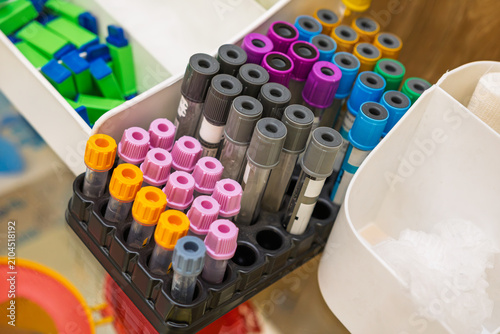 Blood collection tubes prepared for laboratory testing