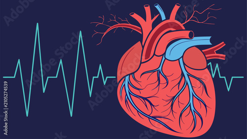 Tableau sur toile Clinical atrial fibrillation illustration for medical education and awareness