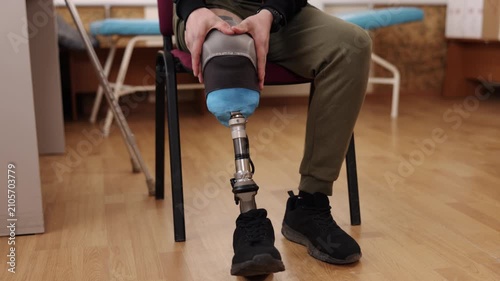 rehabilitation center, recovery process, fitting prosthetic. Environment includes medical tools and support equipment, emphasizing recovery and rehabilitation themes.
