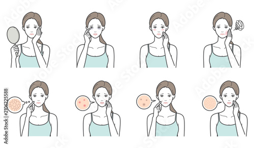 女性の肌トラブルと肌の悩みのイラスト8点セット（乾燥・ニキビ・シミ・毛穴・クマ・赤み）