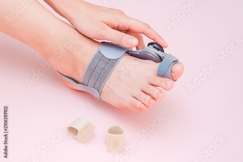 Medical orthopedic bandage and silicone finger separator to treat and prevent Hallux Valgus with adjustment on female foot