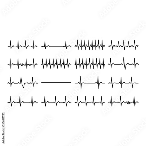Set of heart rhythm ecg lines on white background