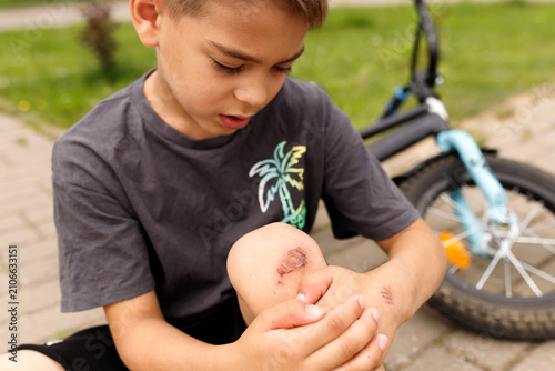 Little boy sitting on pavement looking at scratched wounded knee skin abrasion injury after fall from bicycle accident trauma first aid medical care summer activity childhood problems concept