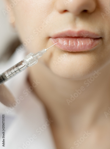 Foto Lip Filler Injection Close-Up — Cosmetic Lip Augmentation Procedure