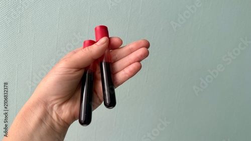 Woman's hand holding two blood test tubes with red caps against light wall background
