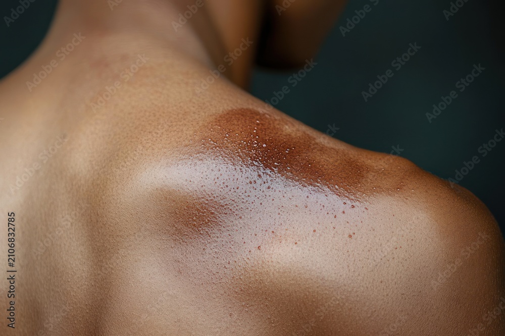 Fototapeta premium close-up of a wet upper back and shoulder with glistening water droplets on warm-toned skin, conveying a calm, refreshed and sensual mood