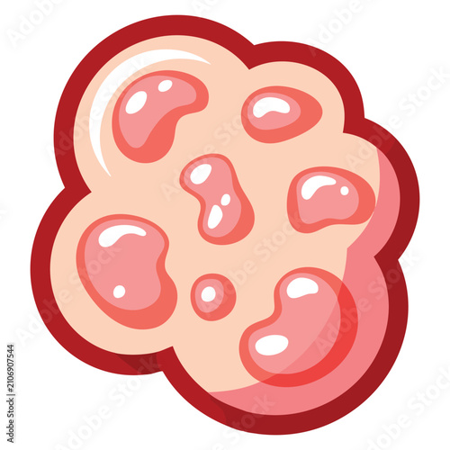 Foto Herpes skin infection and itch isolated flat vector illustration perfect for hea