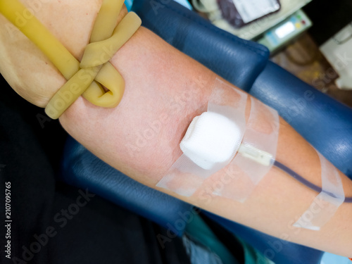 Person donating blood with needle and gauze taped on arm and rubber tourniquet attached.
