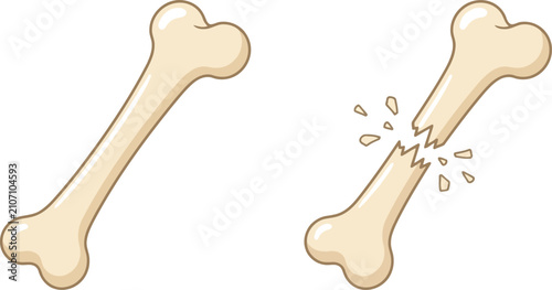 Intact and broken bone icon set