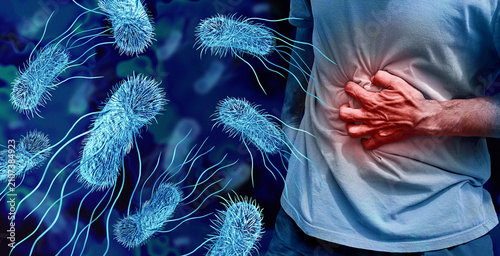 Fotografía E Coli infection as severe stomach pain caused by pathogenic Escherichia coli ba