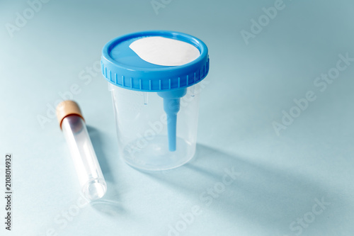 Urine sample collection jar and vacuum tube on blue background, medical diagnostics and laboratory