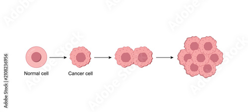 Normal cell and cancer cells. Cancer development. Carcinogens, DNA damage. Malignant tumor. Difference between normal and tumor cells. Scientific design. Vector Illustration.