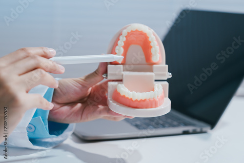 Dental model showing teeth and jaw for oral care consultation with hand pointing beside laptop in clinic office