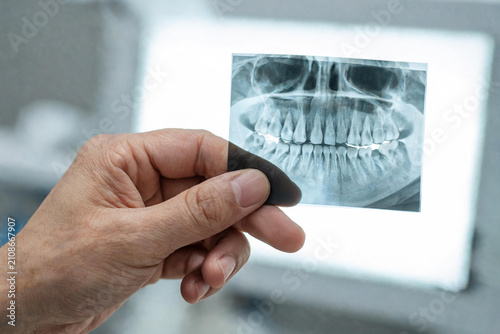 Mano de dentista sosteniendo una radiografía panorámica dental en primer plano frente a un negatoscopio iluminado.