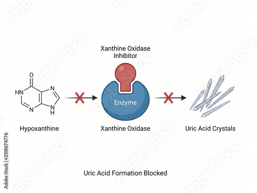 Xanthine oxidase inhibitors demonstrate how hypoxanthine conversion into uric acid crystals is effectively blocked within a cellular enzymatic process for clinical treatment.