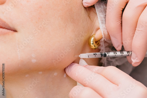 Bild auf Leinwand Las manos aplicando botox en clinica