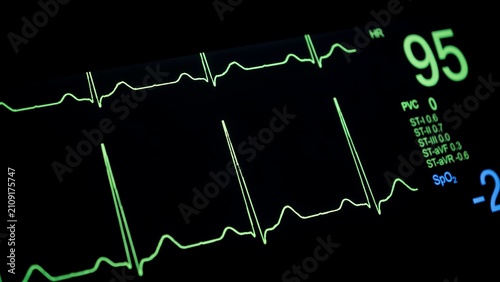 Ecg monitor display showing heart rate and vital signs in intensive care