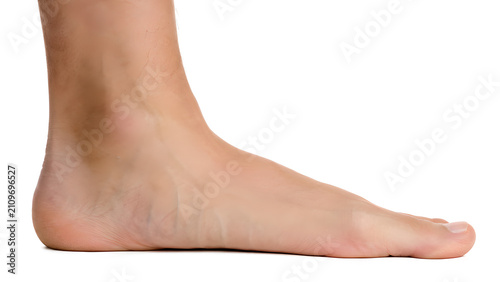 Flat feet with collapsed medial arch in adult foot, photorealistic medical 3D render on white background for podiatry, orthopedic healthcare, medical education, and patient information design