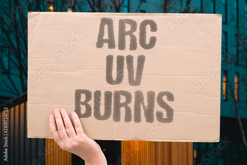 Billede på lærred "Arc UV Burns" Ultraviolet rays from welding injure skin
