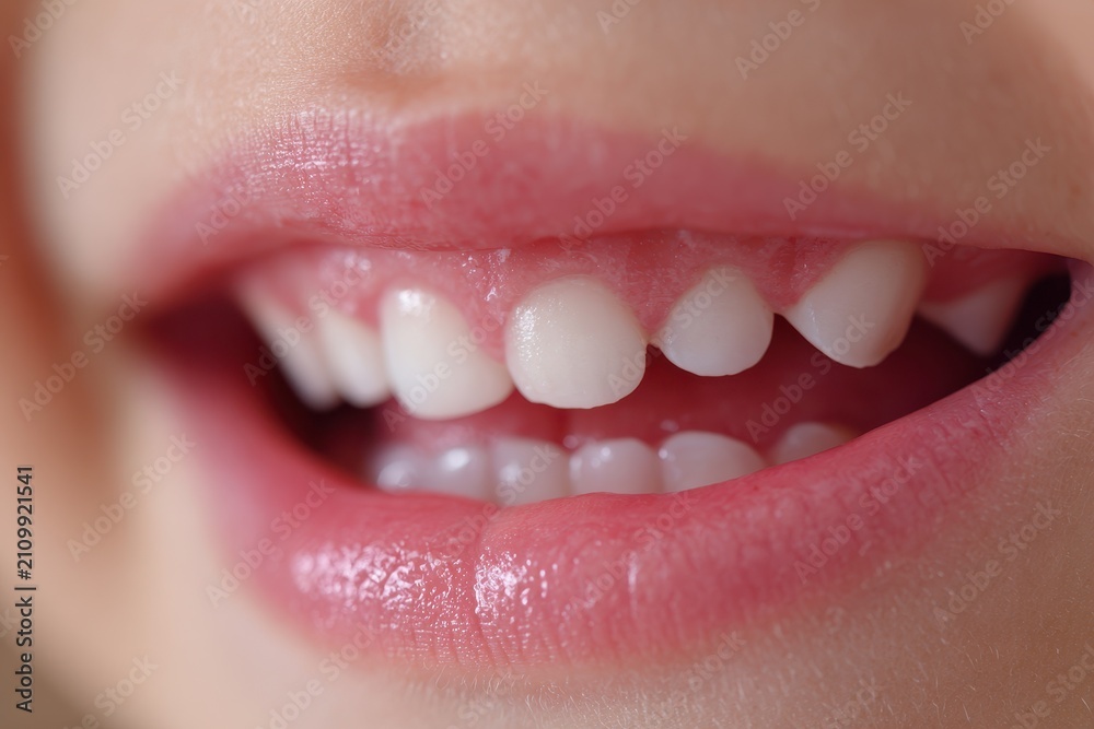 Obraz premium Macro image of pediatric mouth with baby teeth and first permanent molars visible behind