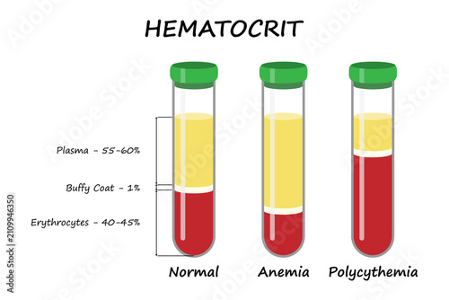 Hematocrit. Medical illustration.