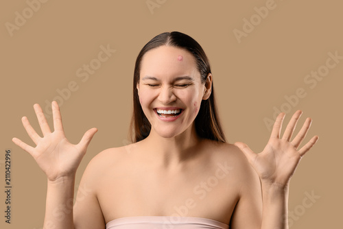 Happy young woman with acne...
