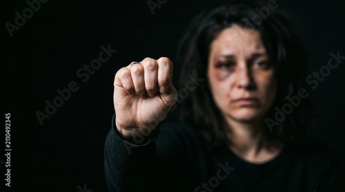 Woman with Bruises on Face Holds Up Fist in Defiance Against Dark Background.