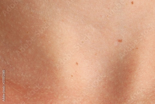Foto Texture of normal skin with birthmarks as background, closeup