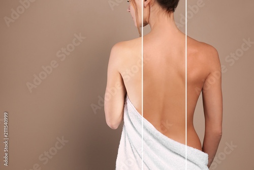 Levels of tanning. Collage showing woman with various skin tones on pastel brown background, closeup