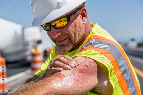 Construction Worker Applying Sunscreen to Forehead