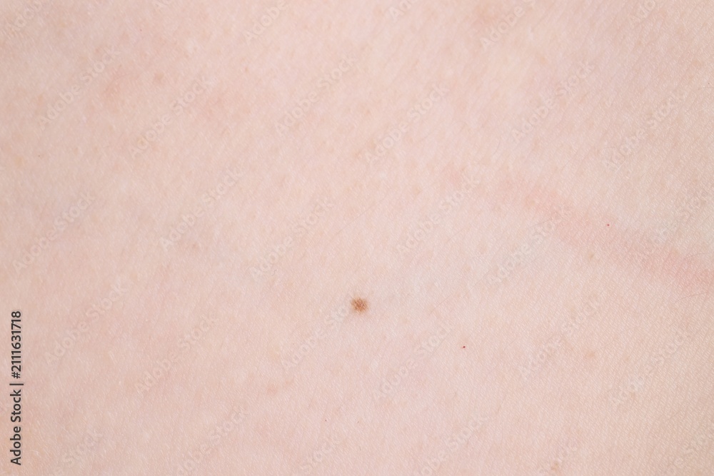 Fototapeta premium Texture of normal skin as background, closeup