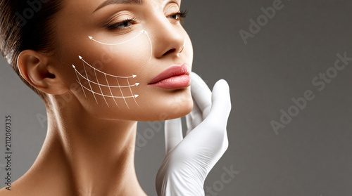 Woman with lifting arrows and grid lines drawn on cheek illustrating facelift skin tightening cosmetic surgery.